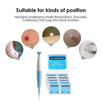 Thumbnail for Rapid Tag Removal Kit