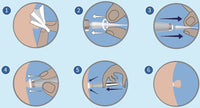 Thumbnail for Rapid Tag Removal Kit
