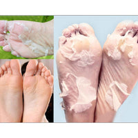 Thumbnail for Baby Foot Exfoliant Foot Peel