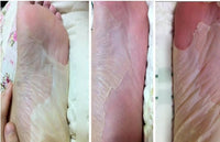 Thumbnail for Baby Foot Exfoliant Foot Peel